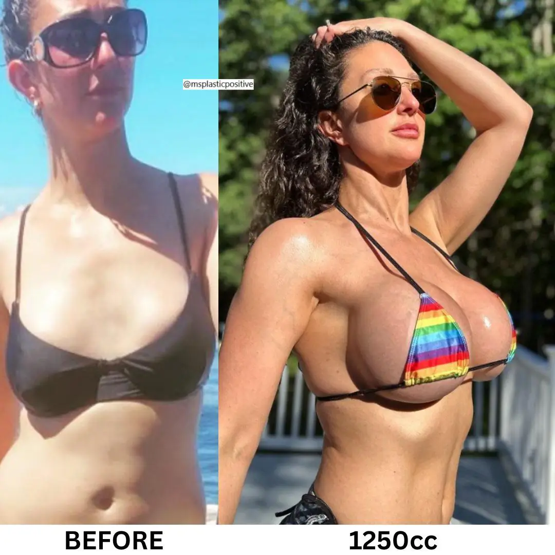 1250cc Bimbo Doll Glow Up: My Seductive Three Year Journey from 34A to 34H