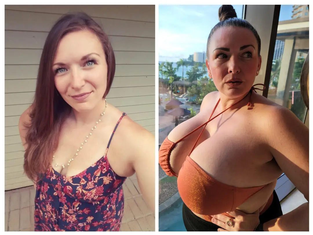 30 Days Until I Become More Boob Than Woman with My Massive 3500cc Upgrade