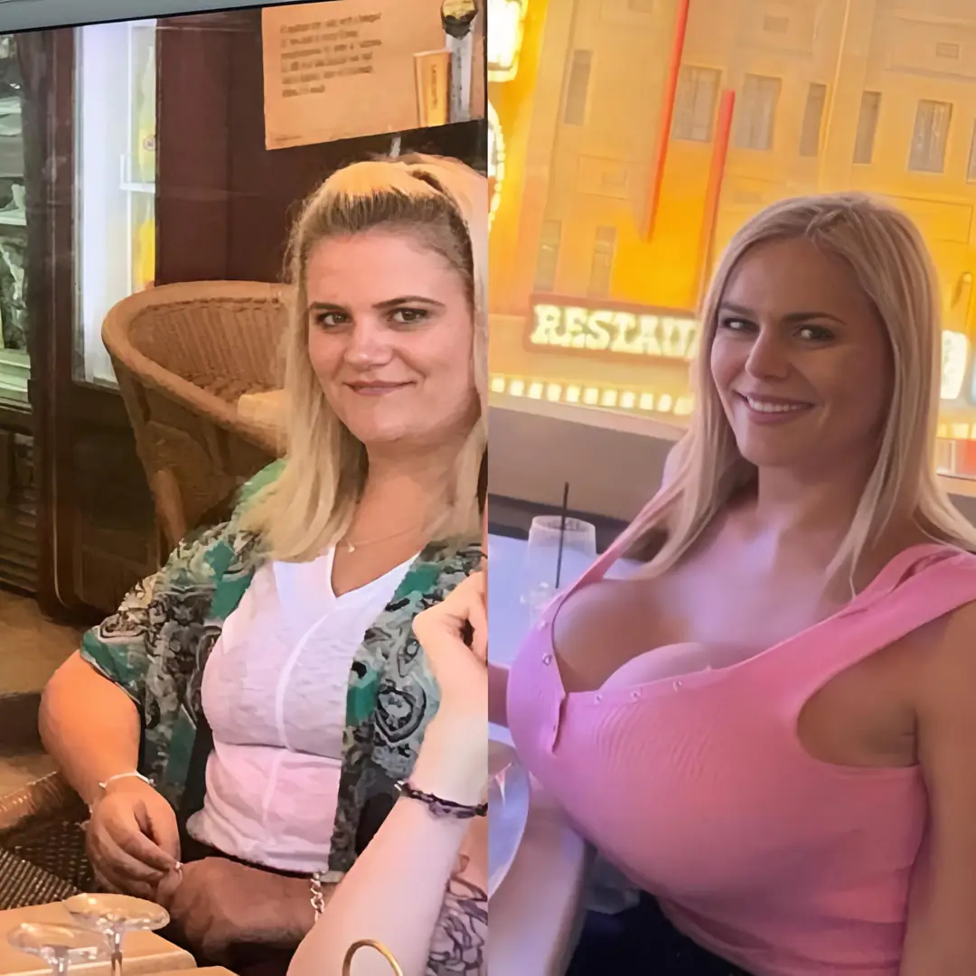Big fake tits and a sexy bust are the only reasons for this amazing smile