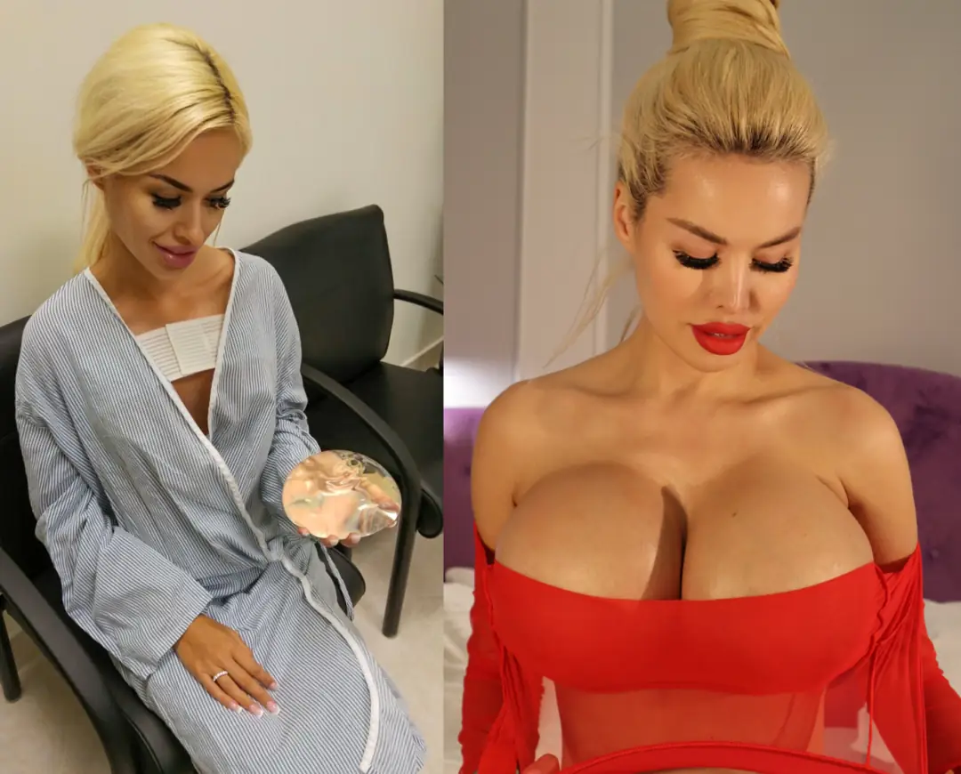 Bimbo Transformation: Boobs, Curves, and a Whole Lot More!