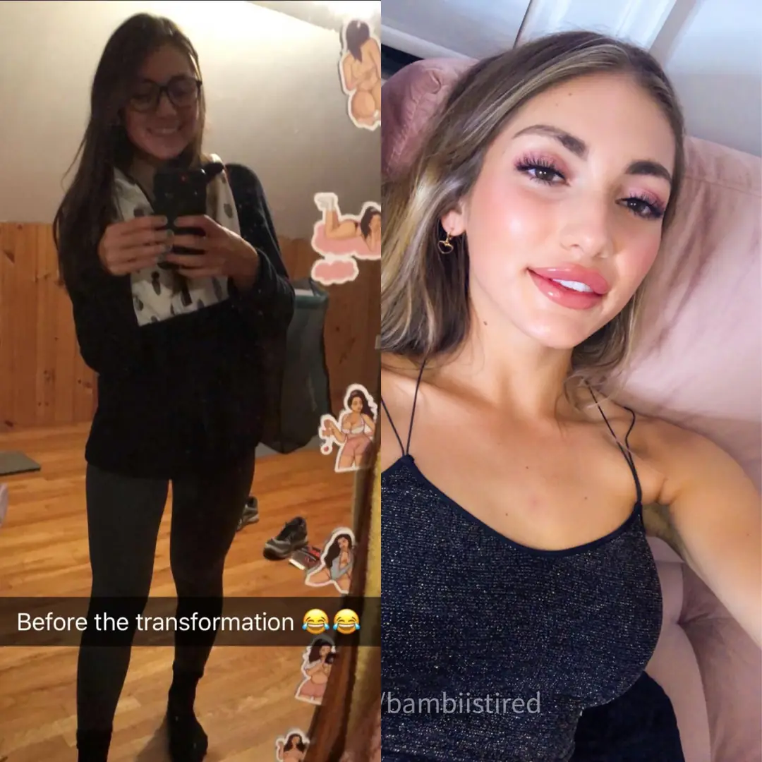 Freshly Plumped & Ready: My New Lips & Where We Go Next 😈