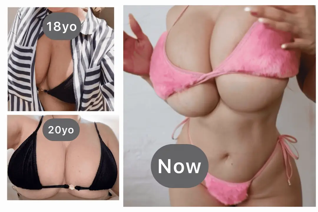 Insane Growth Progression: Busting Out Of My Tiny Teen Bikini Thanks To These Magic Pills