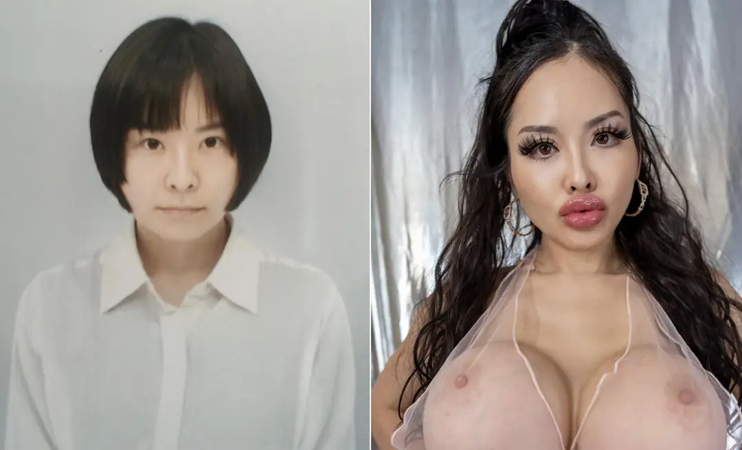 My Plastic Journey to Bimbo Perfection: Getting Prettier for the Big 2026 Jump