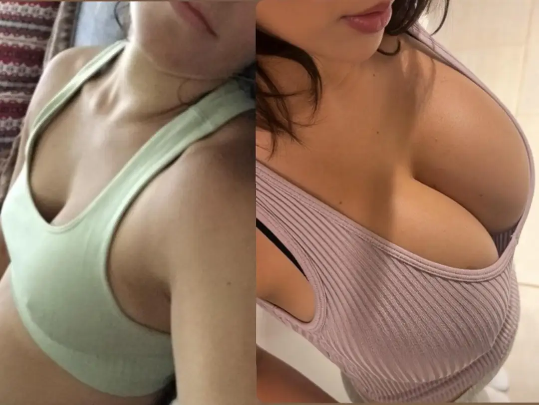 My Stunning Transformation: Bigger Is Always Better And These Alluring Nipples Prove It