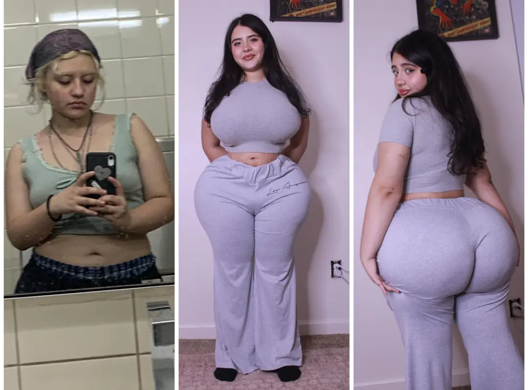 My massive one-year bimbo blow up: 5 surgeries to get these tits, lips, and ass doubled in size