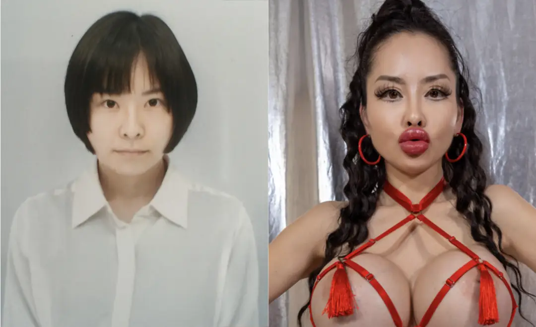 Stage Three Bimbo Queen Chasing 3000cc of Pure Plastic Perfection