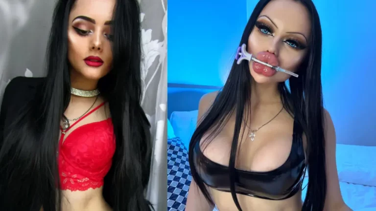 Before or After: Fuckdoll Transformation? Rate My Lips & Boobs!