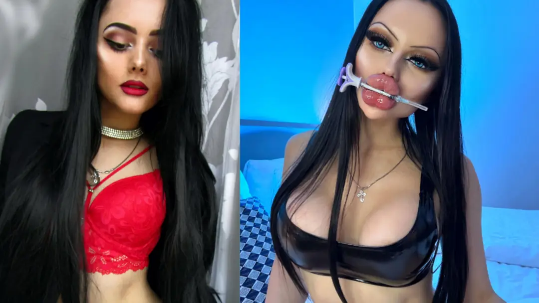 Before or After: Fuckdoll Transformation? Rate My Lips & Boobs!