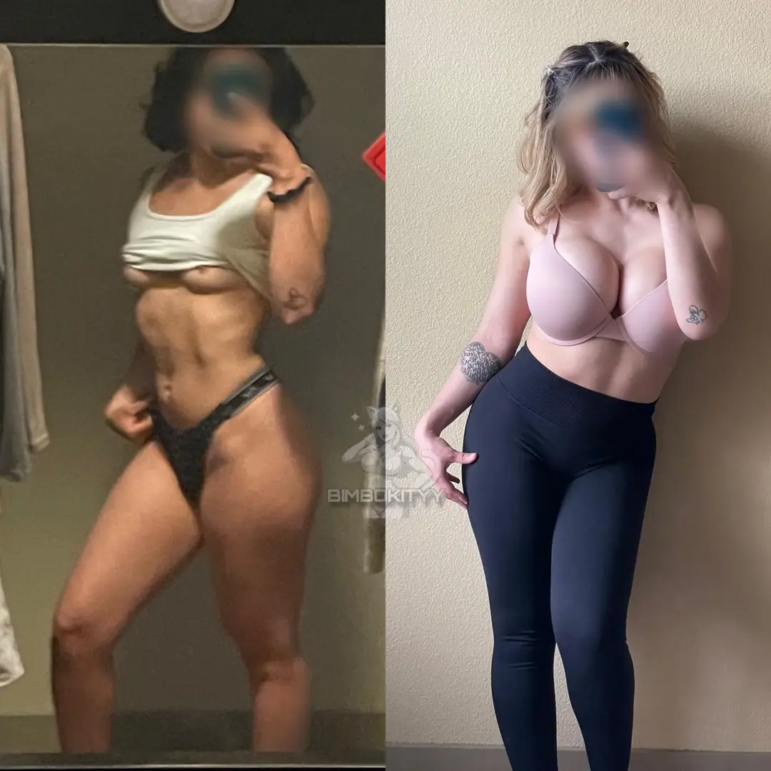 Bimbo Tits or Abs? Rate My Upgrade!