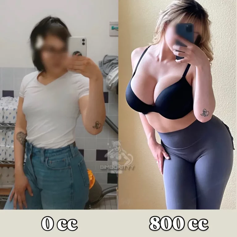 DD Perfection: Is 2000cc My Next Stop for the Ultimate Bimbo Glow Up?