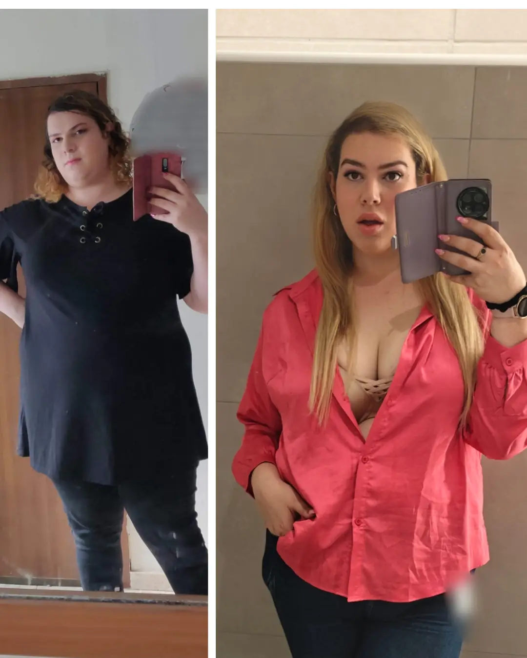 From Basic to Bimbo Bombshell: My Breast Augmentation Transformation!