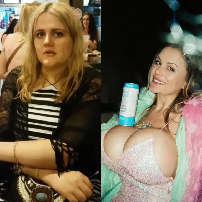 From Boring to Bimbofied: My Boob Job Transformation!