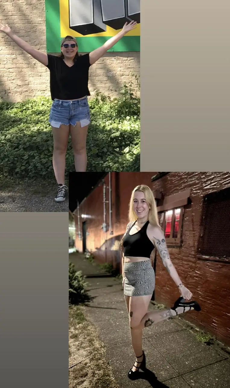 From Cute to Curvy: My Boob Job Transformation!