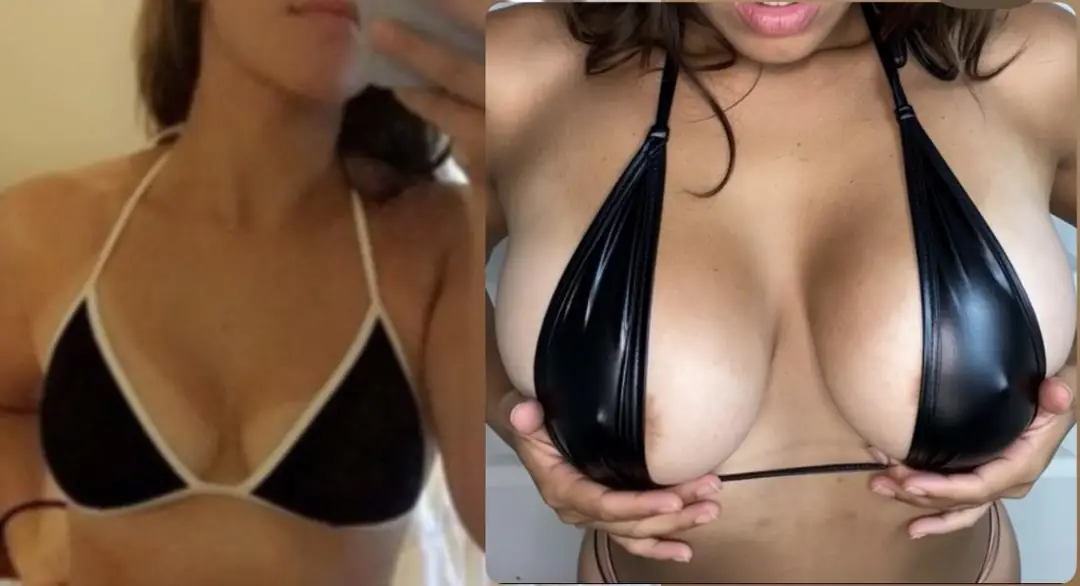 From Hot to Knockout: My Boob Upgrade is Finally Here!