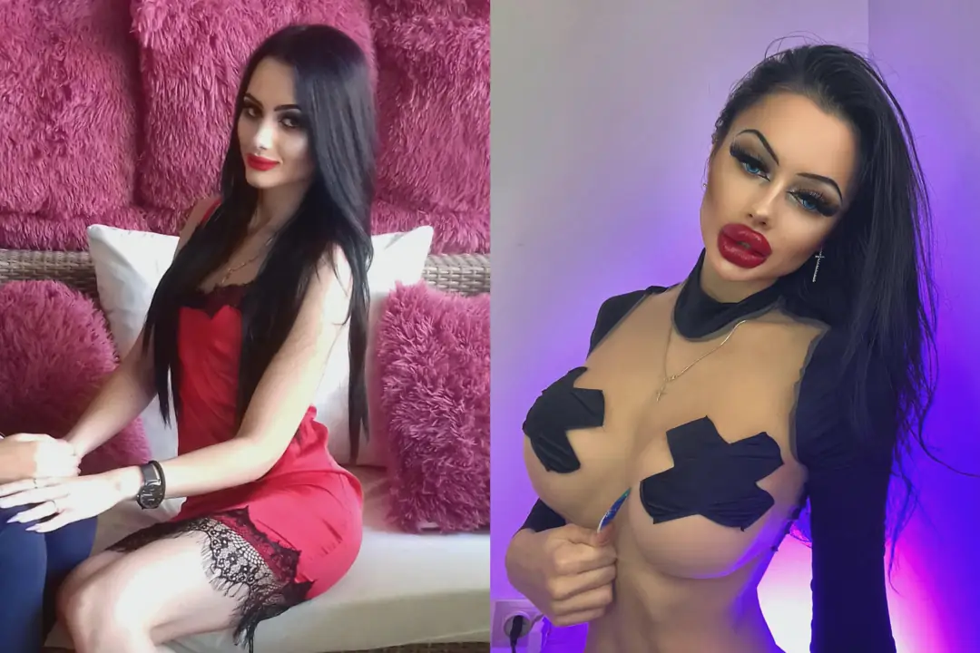 From Nobody to Goddess: My Plastic Transformation & Sugar Daddy Secrets