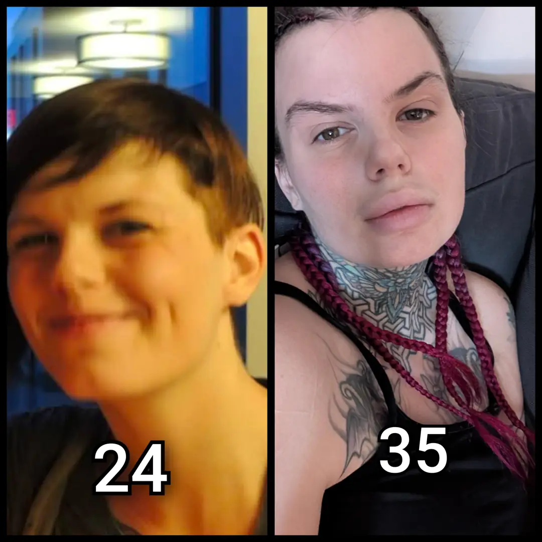 Goth Bimbo Transformation: 24 vs 35 – Bigger Lips & Hotter Than Ever!
