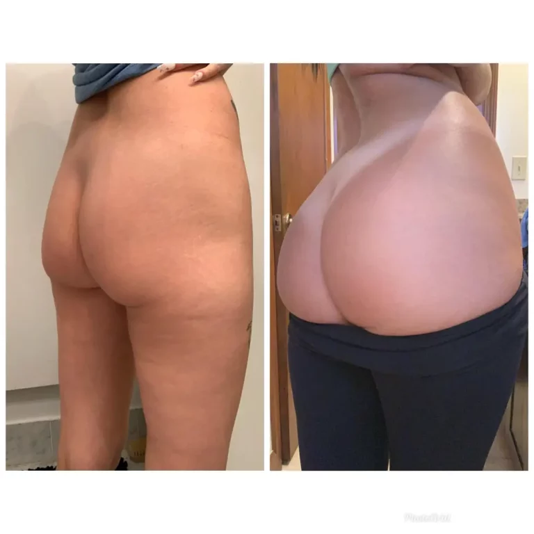 Holy Shit: My Natural Ass, A Perfect Work of Art and Your Dream Peach