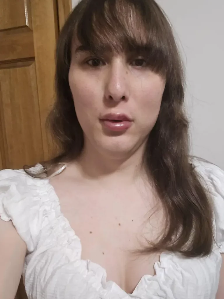 Juicy Lips & Killer Cheekbones: Did I Slay My Filler?