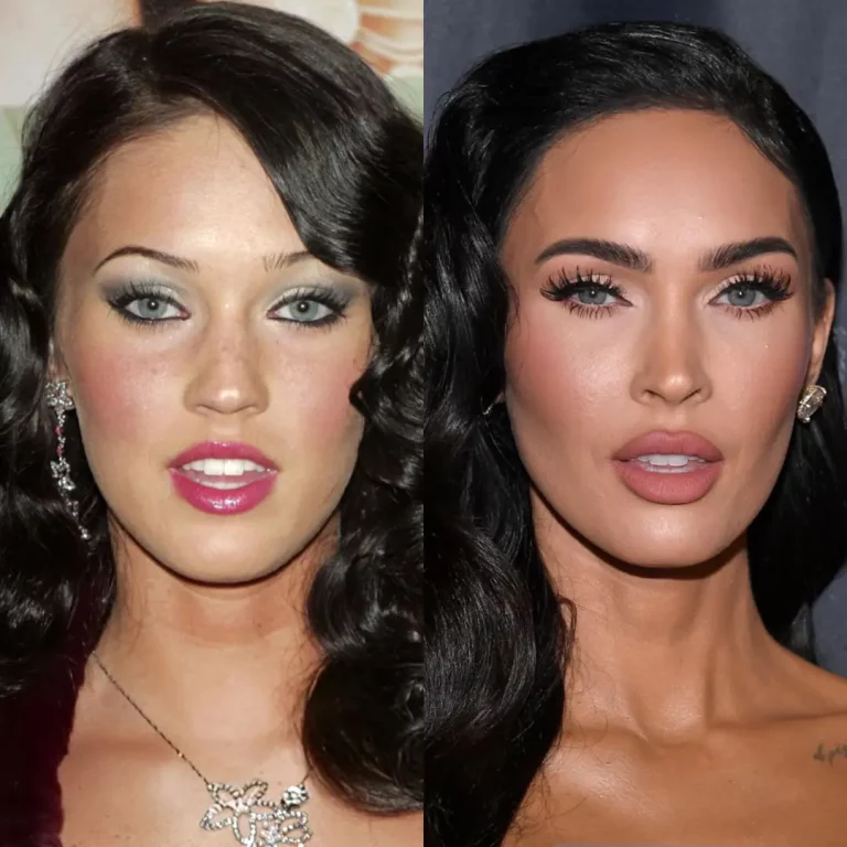 Megan Fox’s Lips: From Soft to Perfect & Puffy – A Transformation!