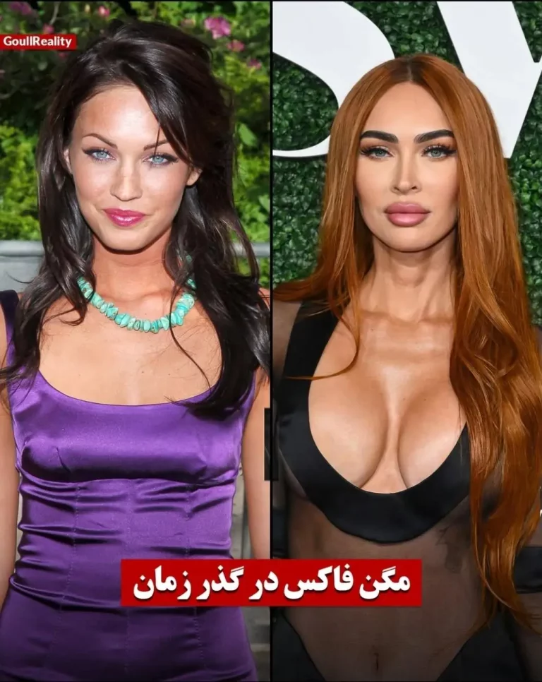 Megan Fox’s Plastic Transformation: Doll-Like Objectification or Ultimate Sexier Upgrade?