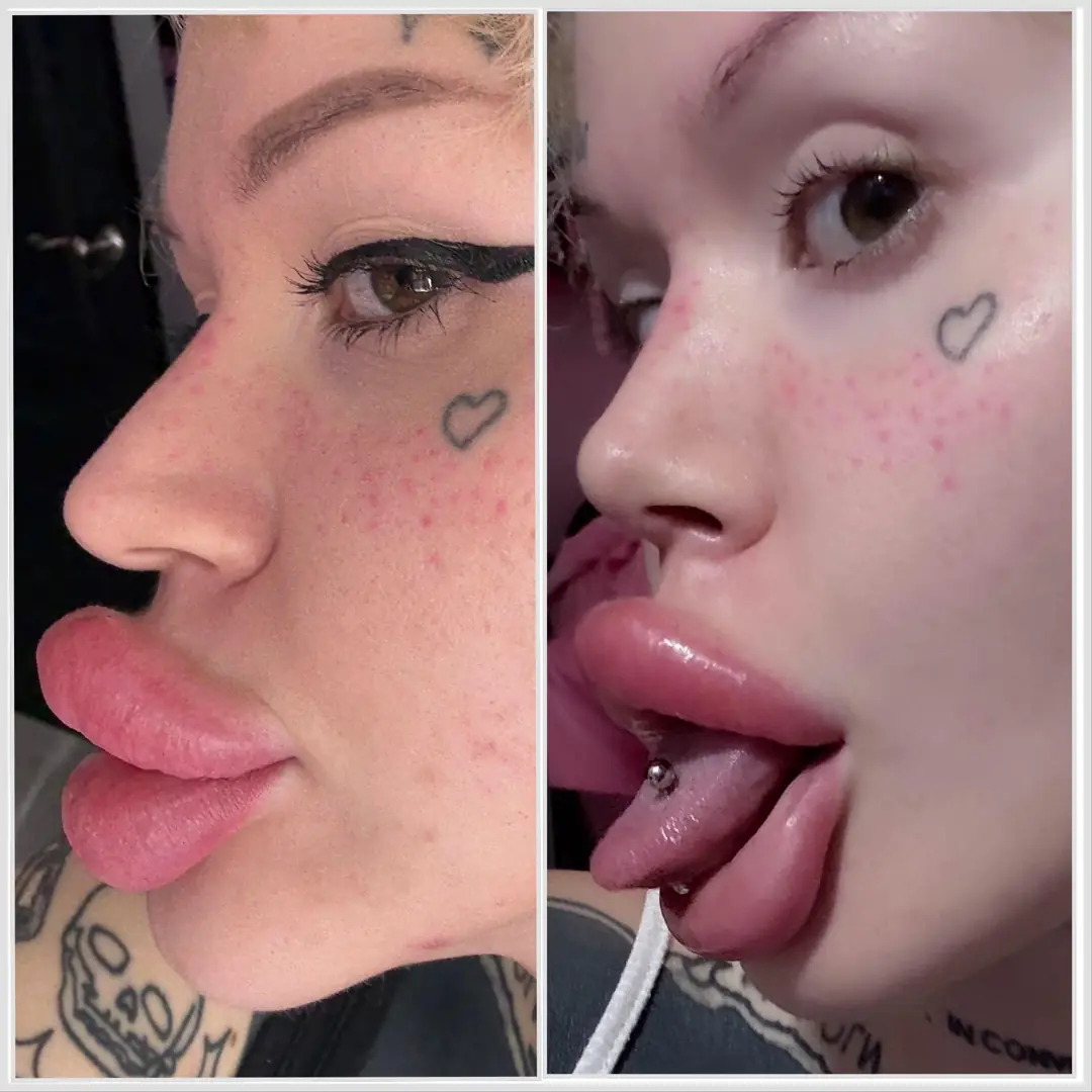 My Bimbofied Face is Complete: These Lip Pillows are Dying to Meet Your Cock!