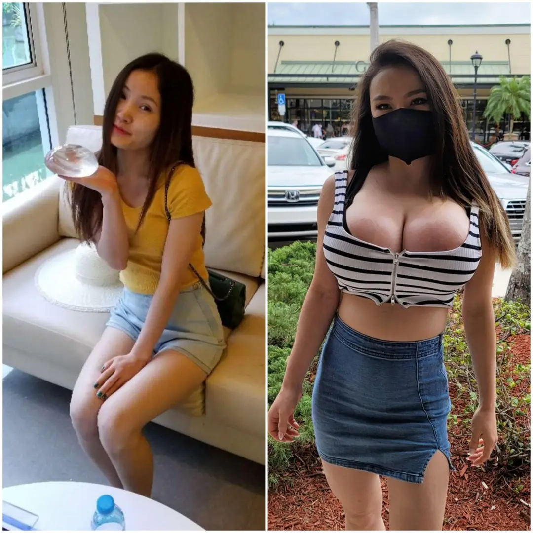 My Epic Plastic Transformation: From Friendzone Cute to Your Everyday Fuck