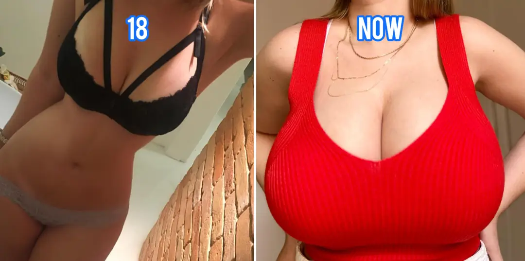 My Natural H Cups Broke Every Bra: See My Perfect Body’s Incredible Glow Up!