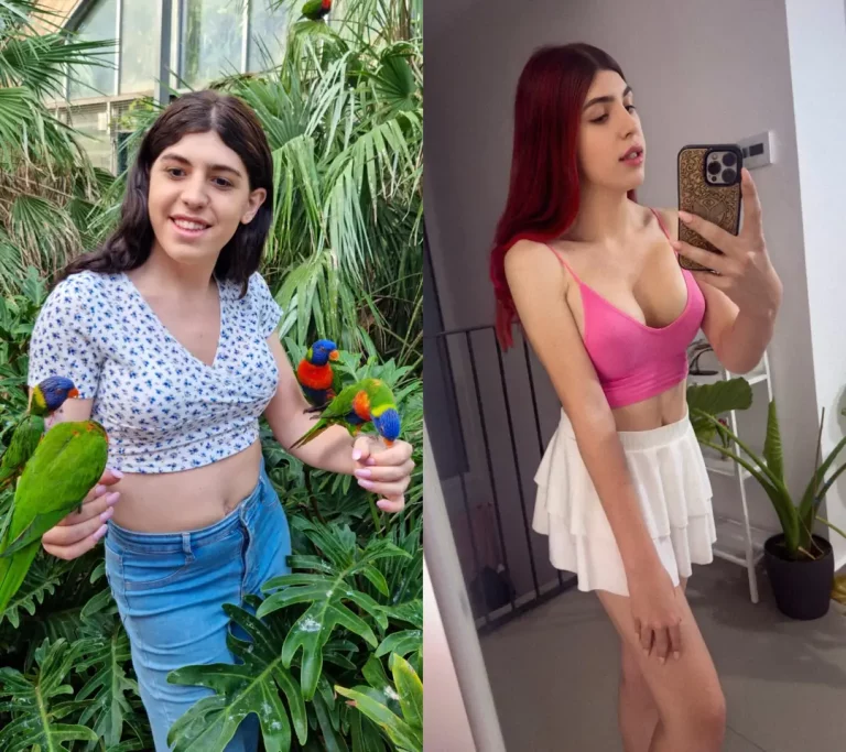 My New Tits are Everything! A Stunning Transformation!