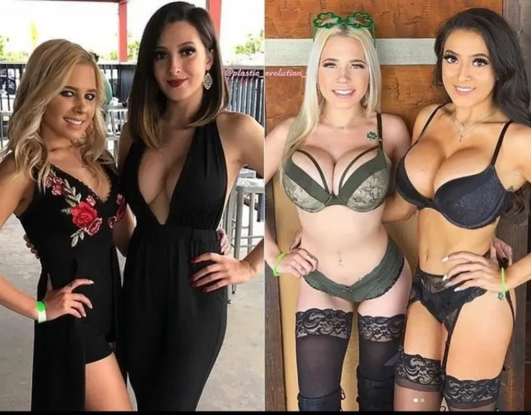 My Stunning Progress: The Lips, Tits, and Absolute Doll Transformation You Crave!