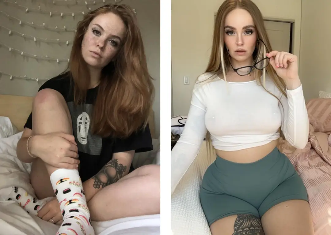 New Boobs, Who Dis? My Breast Augmentation Journey and the Nipple Piercings You’ve Been Waiting For!