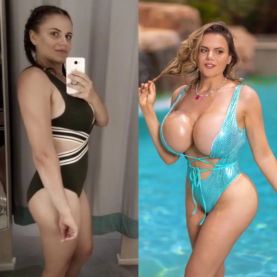 Shed 70lbs of fat, now I’m rocking 20lbs of pure plastic assets. Mesmerizing, right? How much more can I take?!