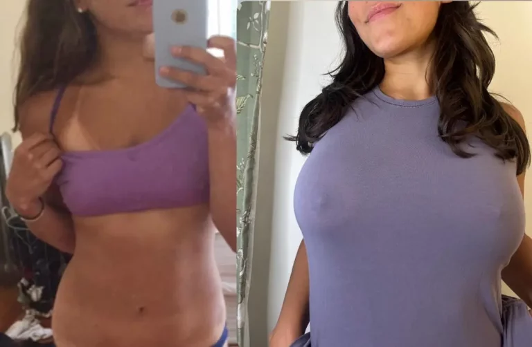 Silicone Dreams: How Big Should I Go? Your Vote Counts!
