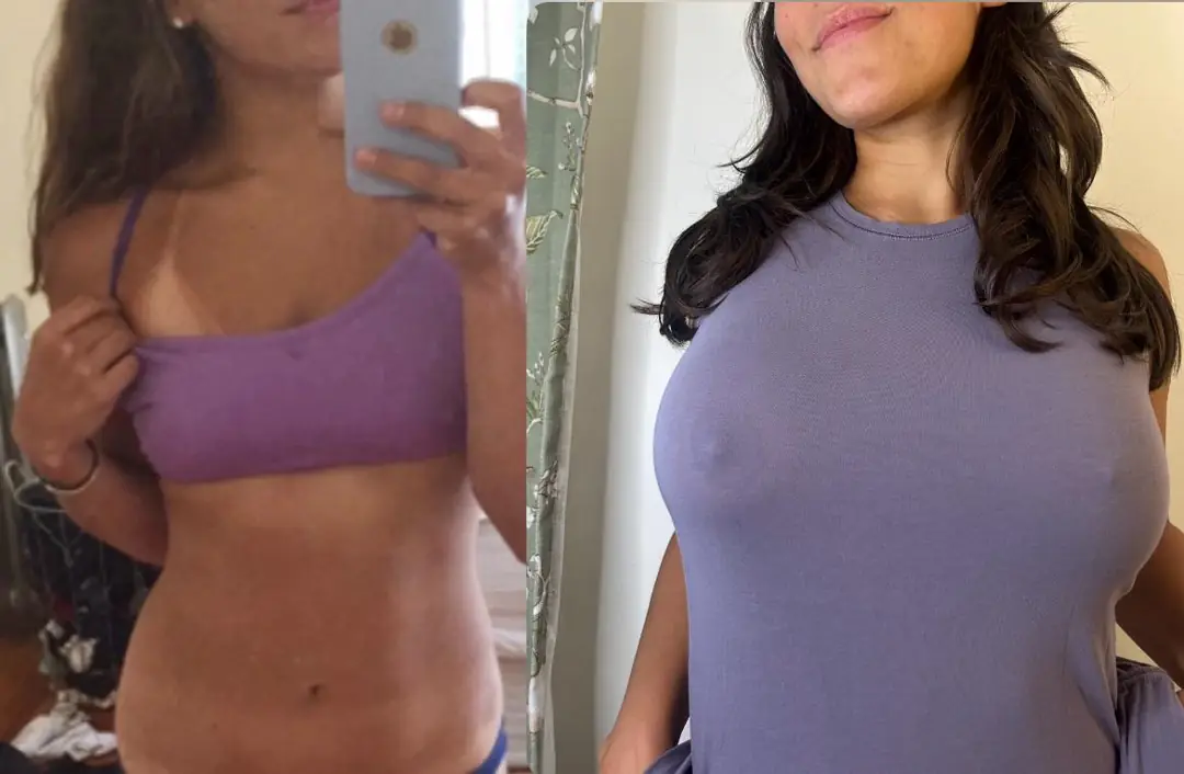 Silicone Dreams: How Big Should I Go? Your Vote Counts!
